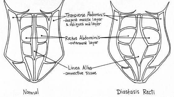 used with permission of Pelvic Floor Professionals. Artwork by Lindsay Hobbs.